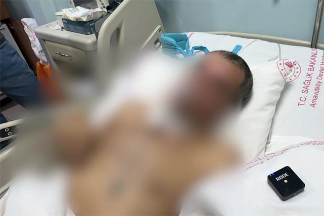 Uzbek Citizen in Critical Condition Evacuated from Türkiye with Consular Support